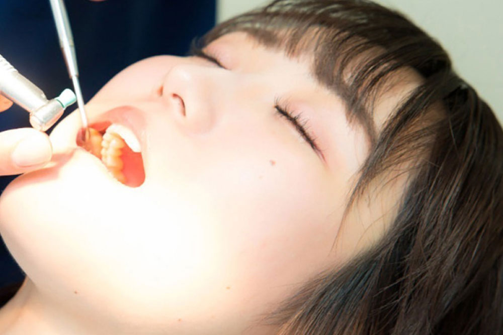 歯石とり・口腔衛生指導