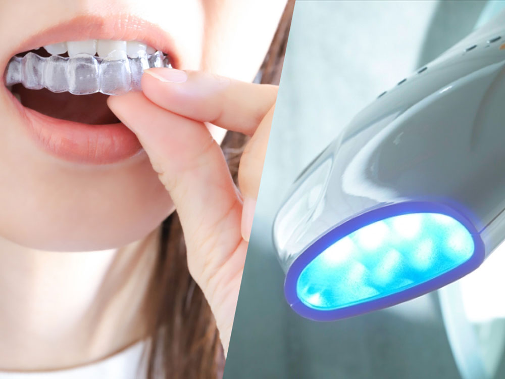 デュアルホワイトニング